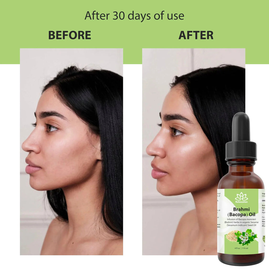 Brahmi (Bacopa Monnieri) Oil, Cold-Pressed Ayurvedic Hair & Scalp Oil, 1 Fl Oz